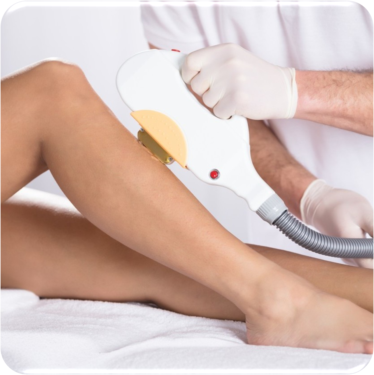 Dauerhafte Haarentfernung mit SHR bei MyBodyCare Langwedel